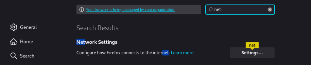 network setting